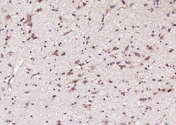 ANKRD33B Rabbit Polyclonal Antibody