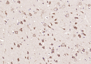 ANKRD33B Rabbit Polyclonal Antibody