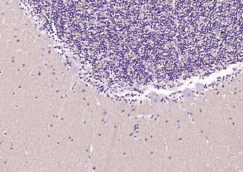 Alpha Synuclein Recombinant Rabbit Monoclonal Antibody