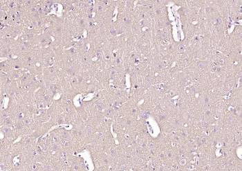 Alpha Synuclein Recombinant Rabbit Monoclonal Antibody