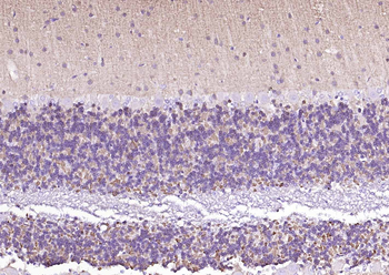 Alpha Synuclein Recombinant Rabbit Monoclonal Antibody