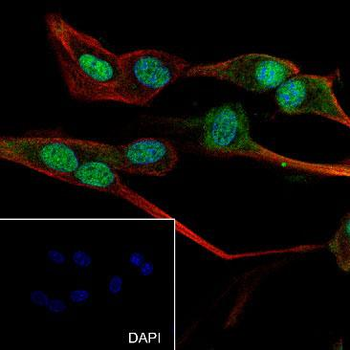 Alpha Synuclein Recombinant Rabbit Monoclonal Antibody