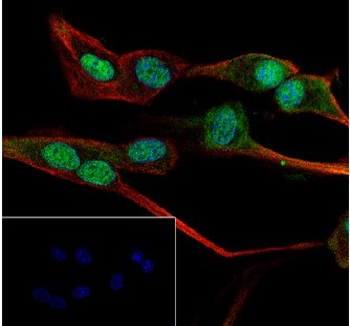 Alpha Synuclein Recombinant Rabbit Monoclonal Antibody