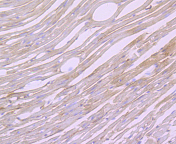 Biglycan Recombinant Rabbit Monoclonal Antibody