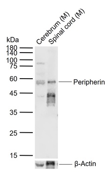 Peripherin antibody