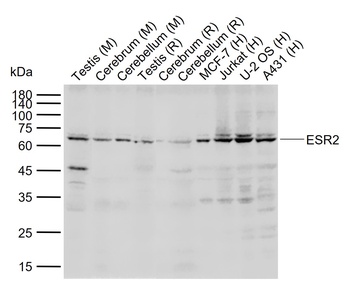 ESR2 antibody