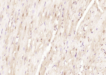 LRRC2 Rabbit Polyclonal Antibody