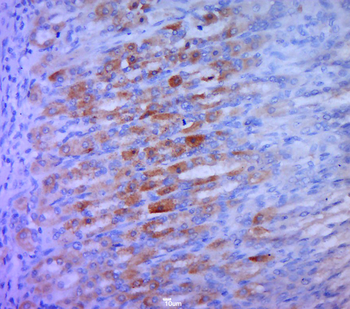 STING1 Rabbit Polyclonal Antibody