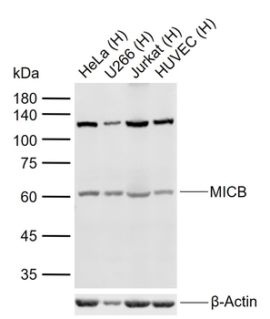 MICB Rabbit Polyclonal Antibody
