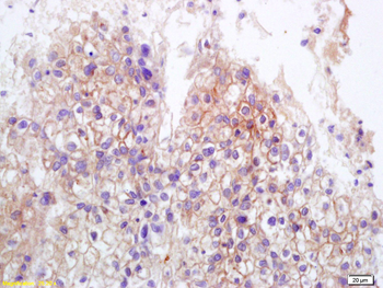 MICB Rabbit Polyclonal Antibody