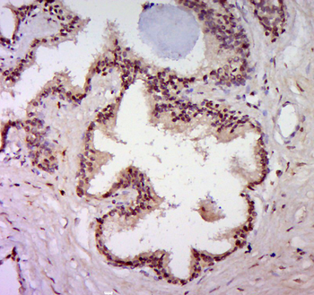 UBE2E2 Rabbit Polyclonal Antibody