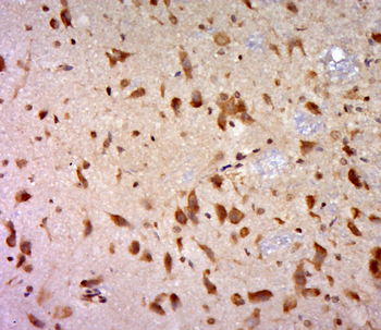UBE2E2 Rabbit Polyclonal Antibody