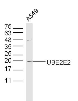 UBE2E2 Rabbit Polyclonal Antibody