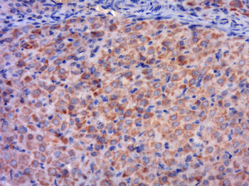 UBE2D4 Rabbit Polyclonal Antibody