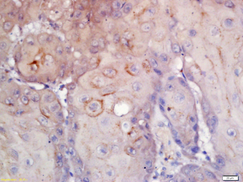 B7-H3/CD276 Rabbit Polyclonal Antibody