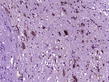 NTN3 Rabbit Polyclonal Antibody