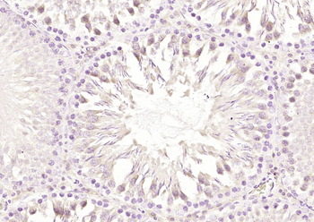 GIPC-2 Rabbit Polyclonal Antibody