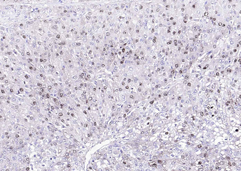 Arginase 1 Rabbit Polyclonal Antibody