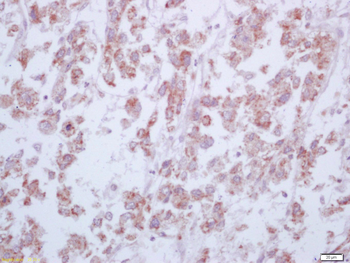 Arginase 1 Rabbit Polyclonal Antibody