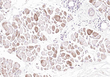 Osteocalcin Rabbit Polyclonal Antibody