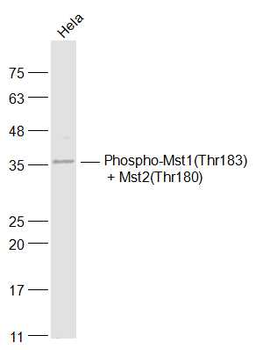 Phospho-Mst1 (Thr183) + Mst2 (Thr180) Rabbit Polyclonal Antibody