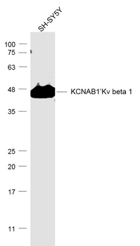 KCNAB1/Kv beta 1 Rabbit Polyclonal Antibody