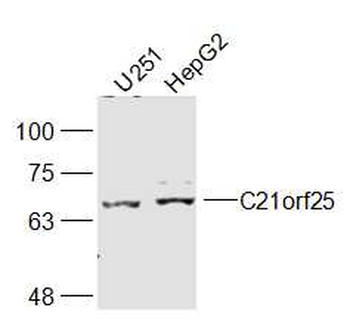 C21orf25 Rabbit Polyclonal Antibody