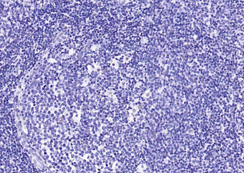 MRE11 Recombinant Rabbit Monoclonal Antibody