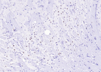 MRE11 Recombinant Rabbit Monoclonal Antibody