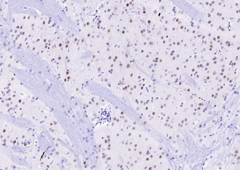 MRE11 Recombinant Rabbit Monoclonal Antibody
