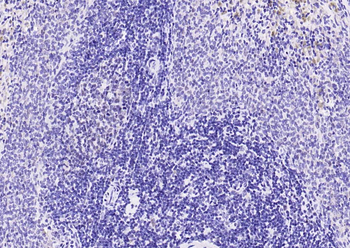 MRE11 Recombinant Rabbit Monoclonal Antibody