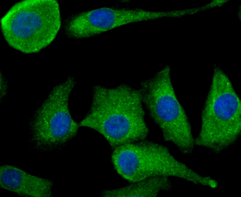 TGF alpha Recombinant Rabbit Monoclonal Antibody