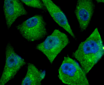 TGF alpha Recombinant Rabbit Monoclonal Antibody