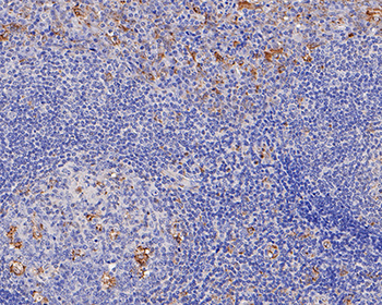 TGF alpha Recombinant Rabbit Monoclonal Antibody