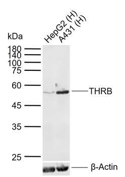 THRB antibody