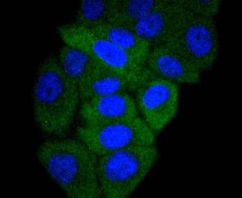 GART Recombinant Rabbit Monoclonal Antibody
