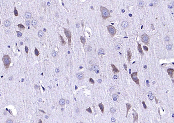 ADAM10 Rabbit Polyclonal Antibody