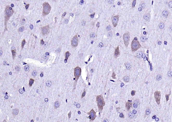 ADAM10 Rabbit Polyclonal Antibody
