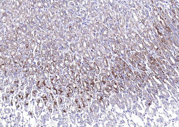 ADAM10 Rabbit Polyclonal Antibody