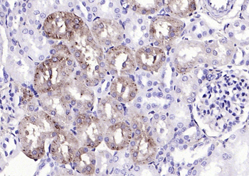 TTR/Prealbumin Rabbit Polyclonal Antibody