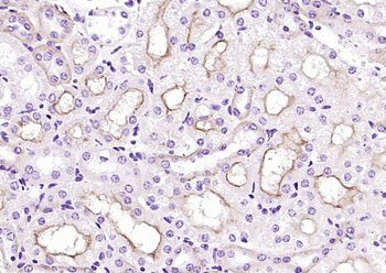 SLC10A2 Rabbit Polyclonal Antibody