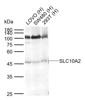 SLC10A2 Rabbit Polyclonal Antibody