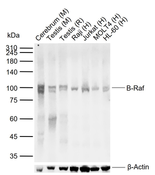 BRAF Mouse Monoclonal Antibody