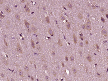 LRCH3 Rabbit Polyclonal Antibody