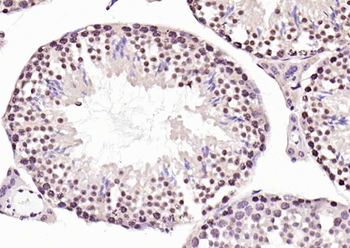RNA polymerase II Rabbit Polyclonal Antibody