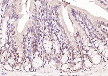 RNA polymerase II Rabbit Polyclonal Antibody