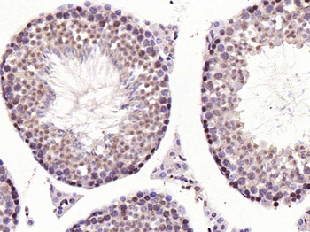 BRN3B Rabbit Polyclonal Antibody