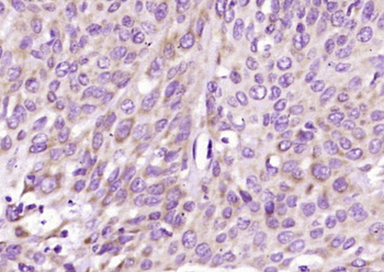 TYMS Rabbit Polyclonal Antibody