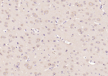 14-3-3 Alpha + Beta + Gamma + Delta + Epsilon Rabbit Polyclonal Antibody