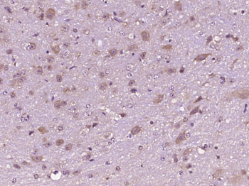 5HT2C Receptor Rabbit Polyclonal Antibody